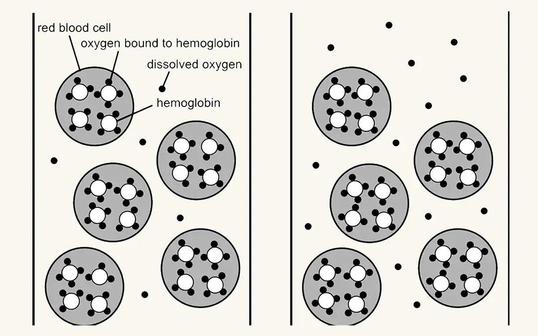 Exploring the Benefits of Mild Hyperbaric Oxygen Therapy for Health Conditions