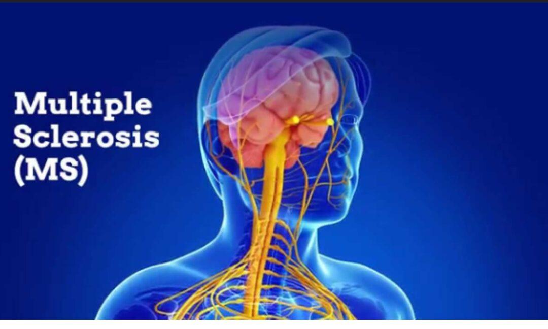 Hyperbaric Oxygen Therapy for Multiple Sclerosis
