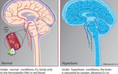 What is Mild Hyperbaric Oxygen Therapy?